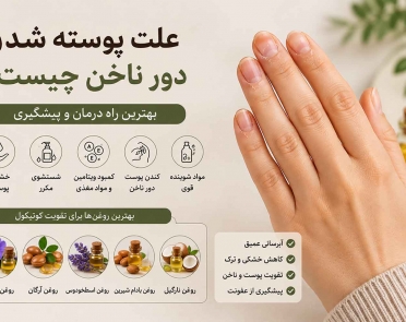 علت پوسته شدن دور ناخن