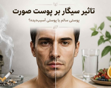 تأثیر سیگار بر پوست صورت