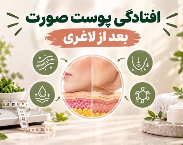 افتادگی پوست صورت بعد از لاغری
